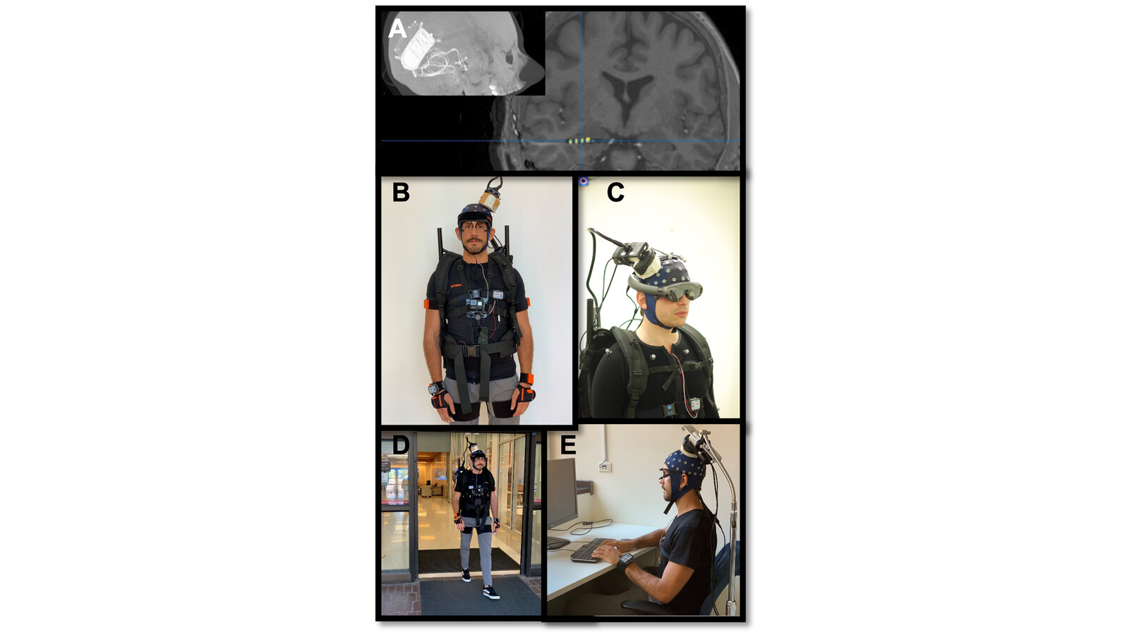Participant setup illustrating mobile sensing and neural recording integration.